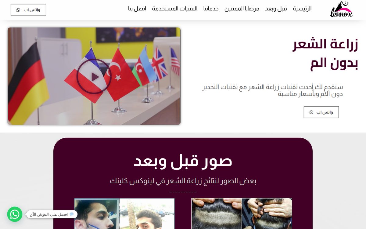 Lennox Clinic — Hair Transplant — website screenshot
